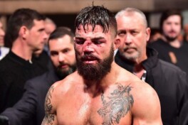 Юраги бўшларга тавсия этилмайди! UFC тарихидаги энг даҳшатли ва қўрқинчи жароҳатлар